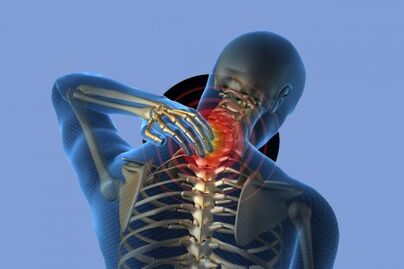 bolest v krku s osteochondrosou