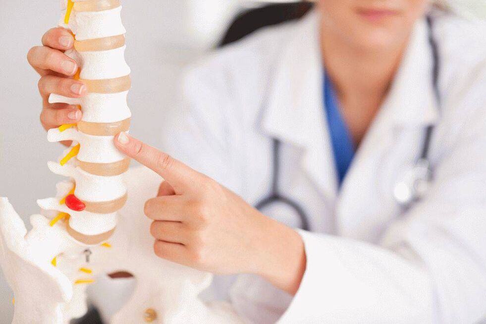 Lékař o osteochondróze a její prevenci
